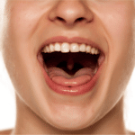 dry-mouth-treatment-crowley