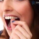Root-Canal-Endodontic-Specialist