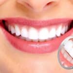 Gum Disease With Diabetes