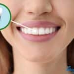 Signs of Dental Implant Failure