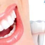 dental-Implant-Success