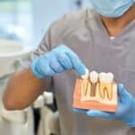 Dental Implants Crowley TX