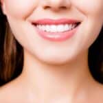 Infection After Dental Veneers