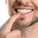 Periodontal Gum Disease Waco, TX