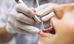 taking care your dental dentures 