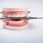 Dental Implant in Dallas, TX