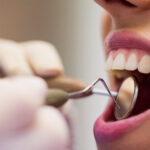 Dental implants in Fort Worth TX