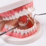 Dental Implants in Houston, TX