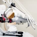 Dental Implants in Fort Worth, TX
