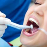 Root canal therapy in Waco TX