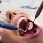 Root canal therapy in Fort Worth TX