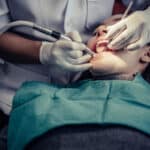 Root canal therapy in Waco TX