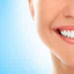 Teeth Whitening in Waco