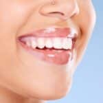 Teeth Whitening in Crowley, TX, Affordable Dentist Near Me - Crowley