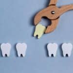 Tooth Extractions in Fort Worth, TX, Affordable Dentist Near Me of Fort Worth