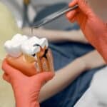 Cavity Prevention in Fort Worth, TX, Affordable Dentist Near Me of Fort Worth