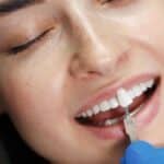 Dental Sealants in Crowley, TX, Affordable Dentist Near Me - Crowley