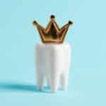 Dental Crown in Grand Prairie, TX, Affordable Dentist Near Me - Grand Prairie
