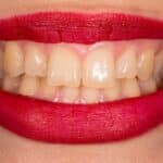 naturally regrow receded gums