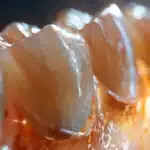 a close-up of a bright, shiny dental implant supported by a healthy gum line, showcasing durability and aesthetics.