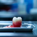 a bloodied tooth lying on a stainless steel tray in a sterile operating room, symbolizing the potential dangers of tooth extraction without anesthesia.