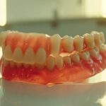 a gleaming row of snap-on dentures, perfectly aligned in a bright, modern dental clinic.
