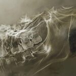 a haunting x-ray image showing a decayed tooth revealing the potential risks of untreated dental issues.
