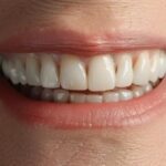 a patient smiling brightly with a brand new set of dental implants installed in just one day.