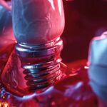 "glistening metal dental implant surrounded by red, swollen gums indicating infection."