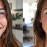 a bright, smiling patient showcasing their radiant dental implants in a vibrant dental clinic, illuminated by soft, natural light to emphasize their confidence and satisfaction.