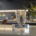 a clear, engaging image of a modern dental clinic illuminated by soft, natural light, featuring a prominent dental implant model on a sleek countertop, symbolizing transparency in dental costs and the importance of addressing hidden fees.