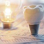 a close-up of a gleaming dental implant against a backdrop of financial documents, illuminated by soft, natural light, symbolizing clarity and transparency in dental care costs.