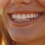 a close-up of a confident individual smiling brightly, showcasing sparkling mini dental implants against a warm, sunlit backdrop in lake worth.