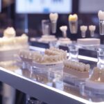 a vibrant and informative dental clinic setting showcasing a comparison chart of various dental implant types highlighted against a backdrop of modern dental equipment, illuminated by soft, natural lighting to emphasize the professionalism and innovation of dental care in lake worth.