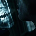 a close-up of a patient anxiously examining a dental x-ray, revealing a detailed view of a dental implant surrounded by shadowy, intricate bone structures, illuminated by soft, diffuse lighting to emphasize the tension of potential hidden complications.