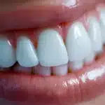 a radiant smile glows brightly in a warmly lit dental clinic, showcasing the transformative power of local dental implant services.