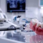 a sleek dental clinic environment showcases a side-by-side comparison of polished dentures and advanced dental implants, emphasizing their distinct structures under bright, clinical lighting.