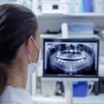 a clinical dental office setting showcases a close-up of a dental professional analyzing a patient's x-ray, with a focus on subtle indicators of potential complications arising from an implant.