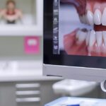 a close-up view of a dental professional examining a digital image of gum health on a high-tech monitor in a modern dental office, highlighting the critical relationship between gum infections and the stability of dental implants.