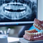 a modern dental clinic with a focused clinician examining a detailed 3d model of dental implants and sunken gums, highlighting the importance of healthy gum tissue for successful dental procedures under bright, clinical lighting.