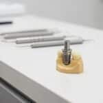 Dental implant model showcasing titanium post and prosthetic crown in a modern dental office