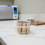 Dental implant model on a countertop in a dental office, emphasizing dental health and treatment options