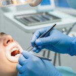 Dental professional performing a tooth extraction, highlighting safety and care in dental procedures