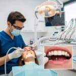 Dental professional examining a patient for mini dental implants in a modern clinic