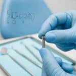 Mini dental implant held by a dentist in a clinical setting, highlighting its small size and design