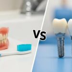 Comparison of dentures and dental implants showcasing dental restoration options