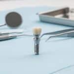 Dental implant made from biocompatible materials in a professional dental setting