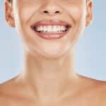 Dental-Bridges-in-Fort-Worth-TX