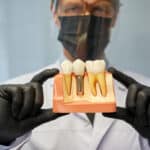 Dental Implants in Fort Worth