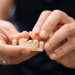 Dental Crowns in Longview